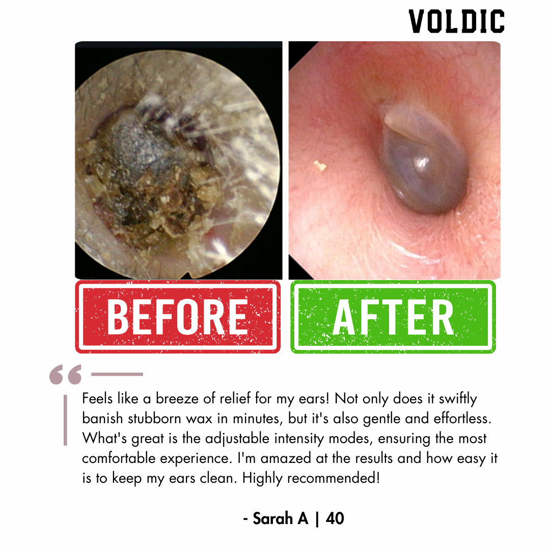 Voldic™ Electric Ear Wax Removal Kit