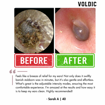 Voldic™ Electric Ear Wax Removal Kit