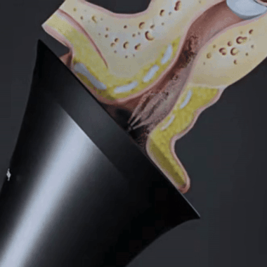 Voldic™ Electric Ear Wax Removal Kit