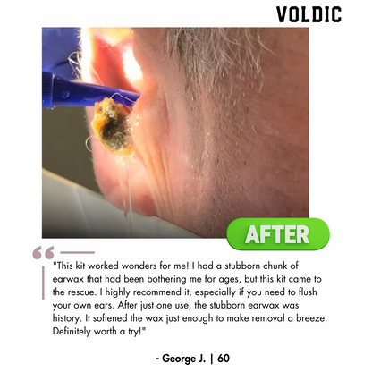 Voldic™ Electric Ear Wax Removal Kit