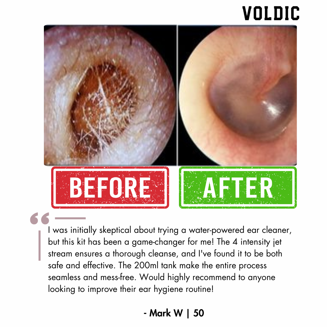 Voldic™ Electric Ear Wax Removal Kit